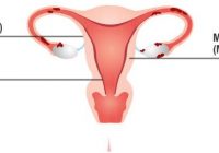 endometrium definition