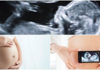 prenatal ultrasound technician