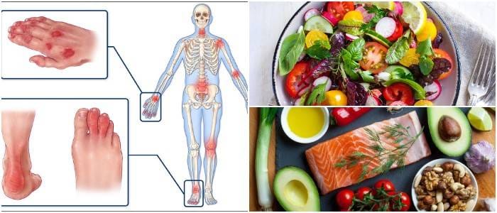 Vegan Diet For Psoriatic Arthritis