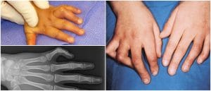 congenital or acquired anomaly